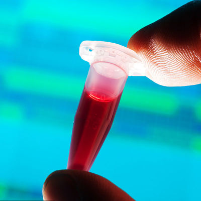 Phòng thí nghiệm kiểm tra được FDA chấp thuận Phát hiện nhanh Thực phẩm Bình sữa trẻ em Liên hệ Dịch vụ xác thực của bên thứ ba